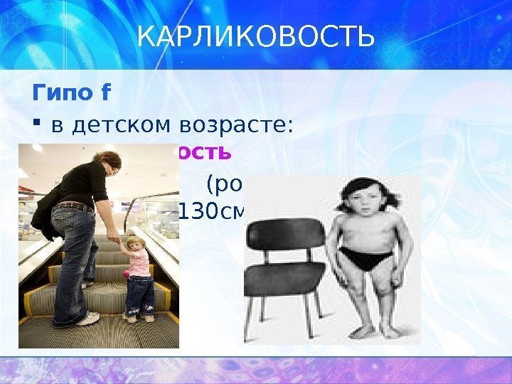 КАРЛИКОВОСТЬ Гипо f  в детском возрасте:  карликовость     